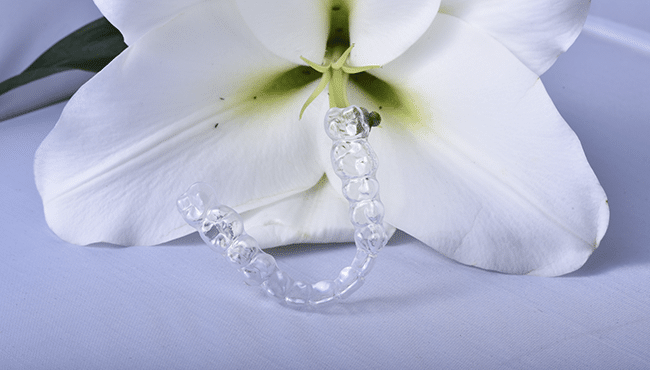 L'orthodontie adulte Par Aligneurs