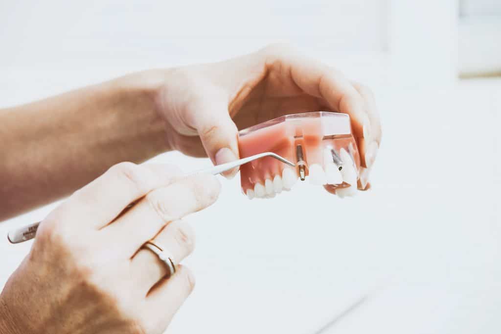formation dentiste en implantologie